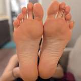 amydepic