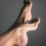 natarches